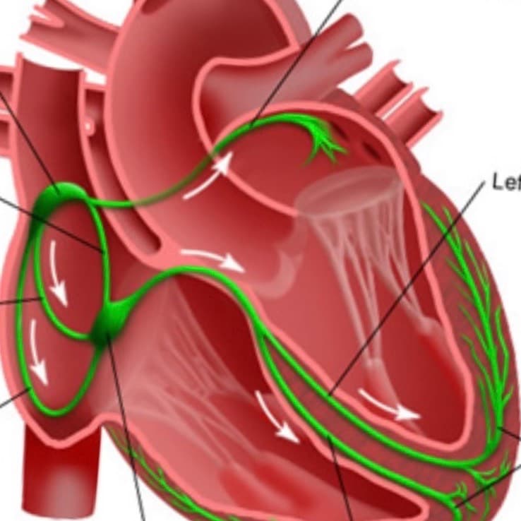 Thumbnail of Heart of human 