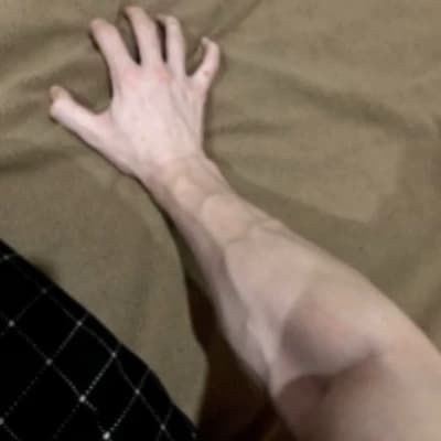 Thumbnail of Liam