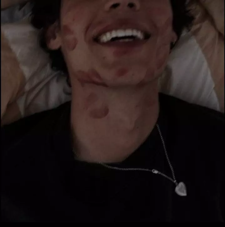 Thumbnail of Asher